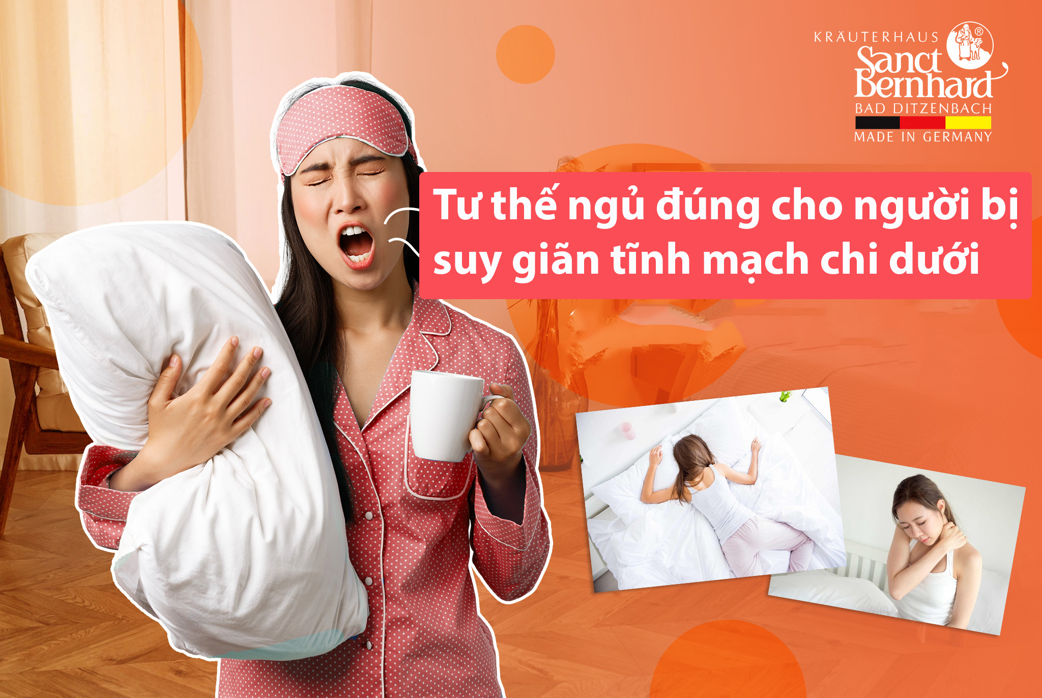 Tư thế ngủ đúng cho người bị suy giãn tĩnh mạch chi dưới